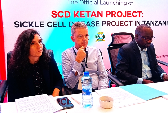 Watoto, vijana 75,500 watarajiwa kufanyiwa uchunguzi kubaini mapema kama wana sikoseli